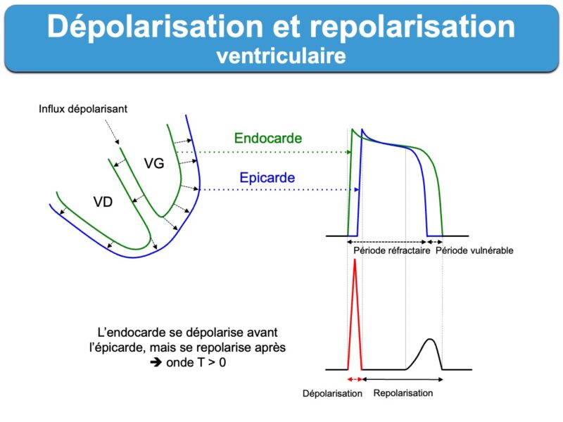 Repolarisation Ventriculaire E Cardiogram