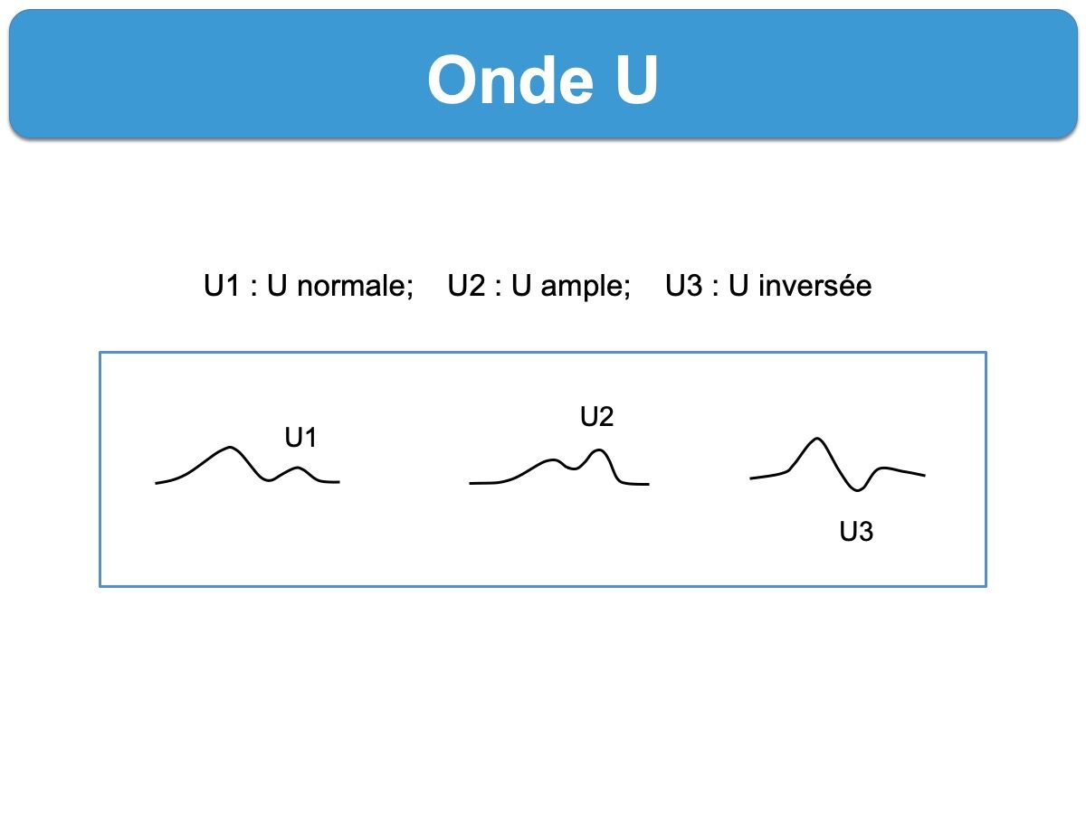 Onde U E Cardiogram