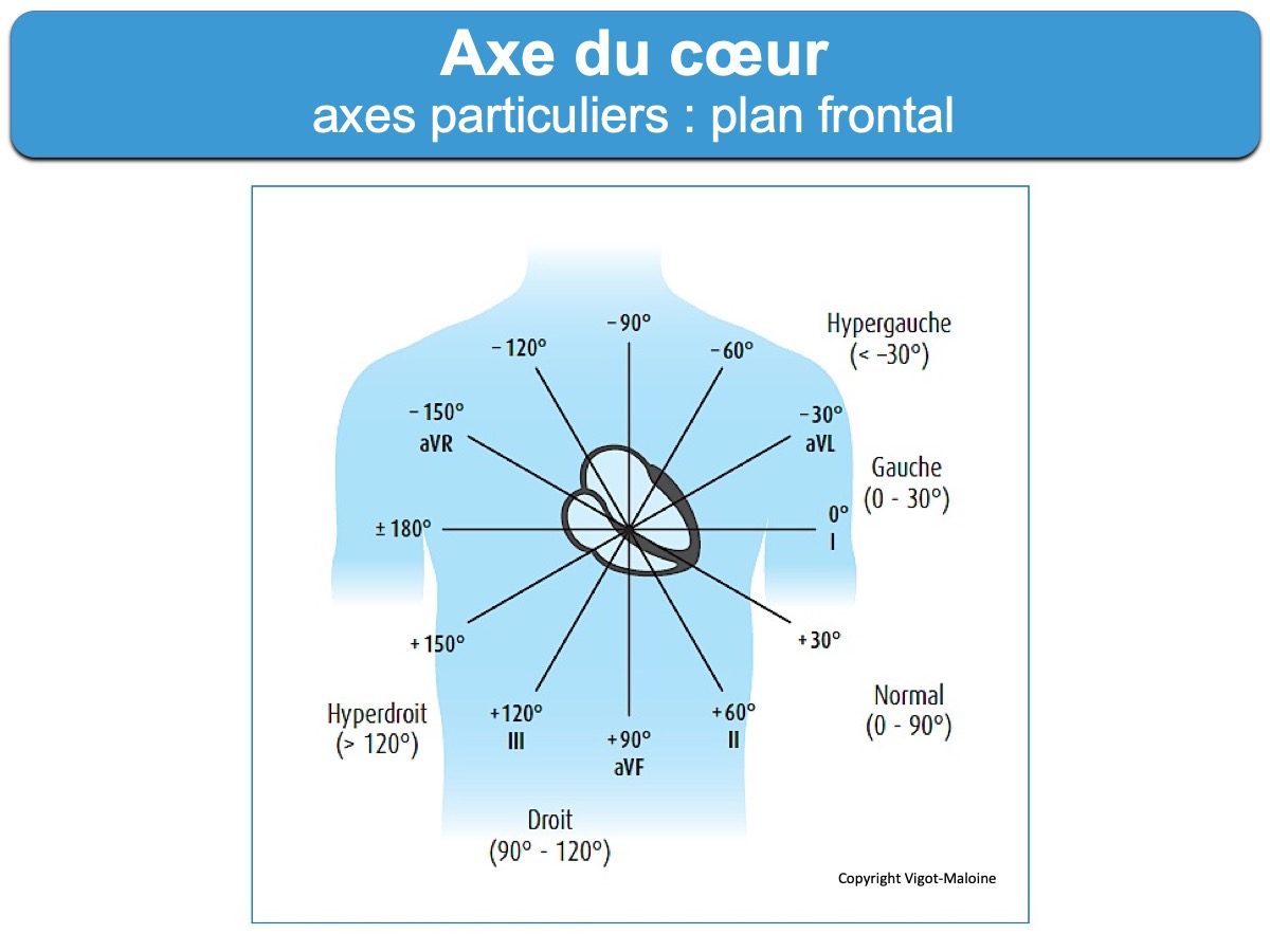 Axe Des QRS : E-cardiogram