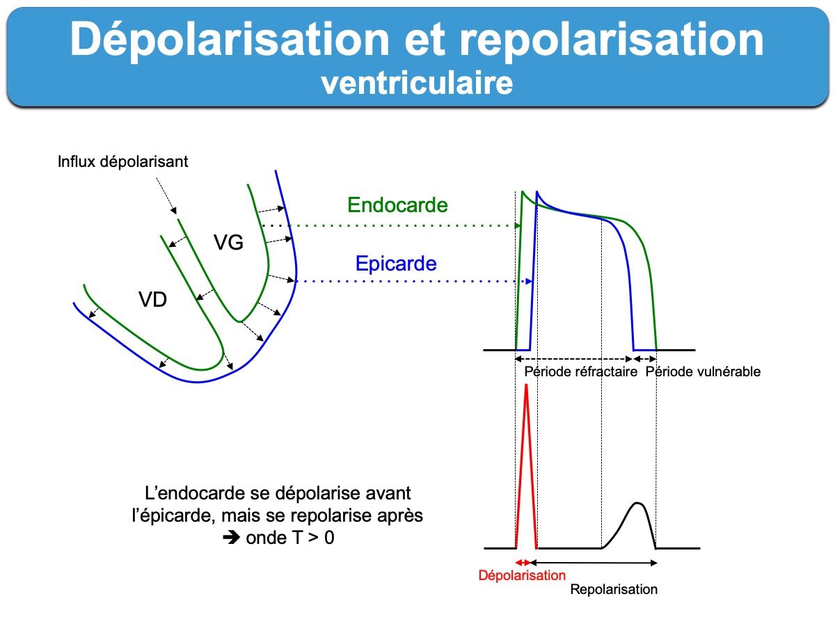 Repolarisation Ventriculaire E Cardiogram