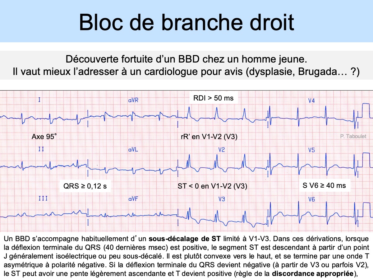 BBD à 40 Ans : E-cardiogram