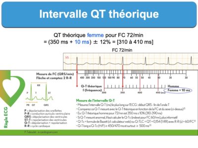 Intervalle QT. 1. Mesure : E-cardiogram