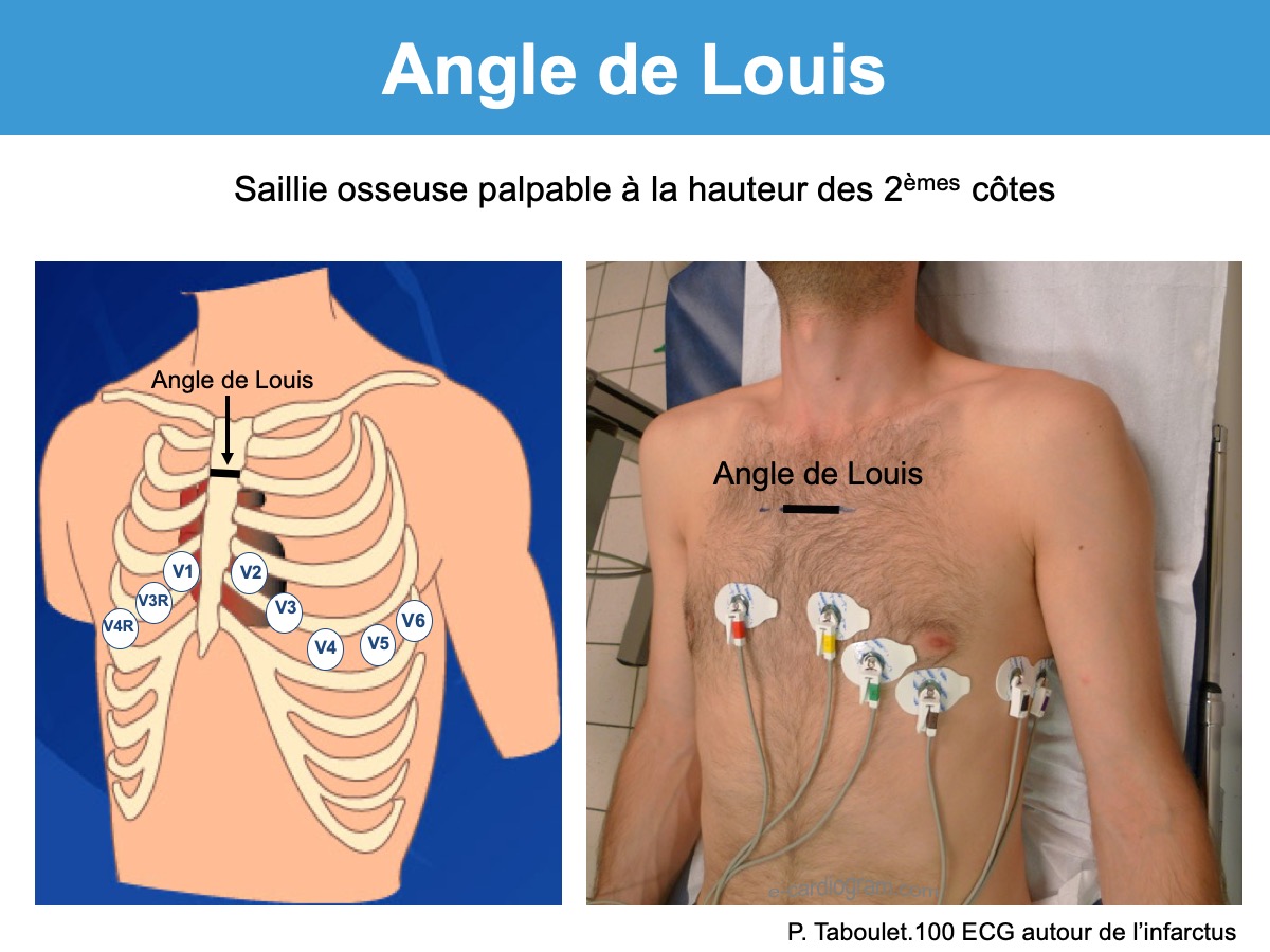 Angle Of Louis Anatomy