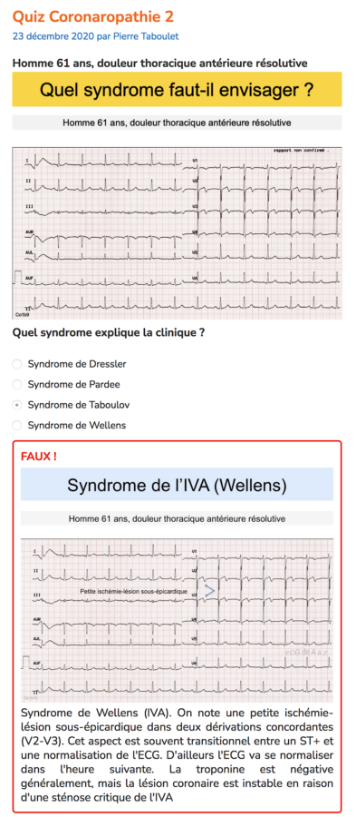 Bienvenu E S Dans Ecg Land E Cardiogram